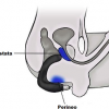 Vibrador prostático sencillo - Image 2